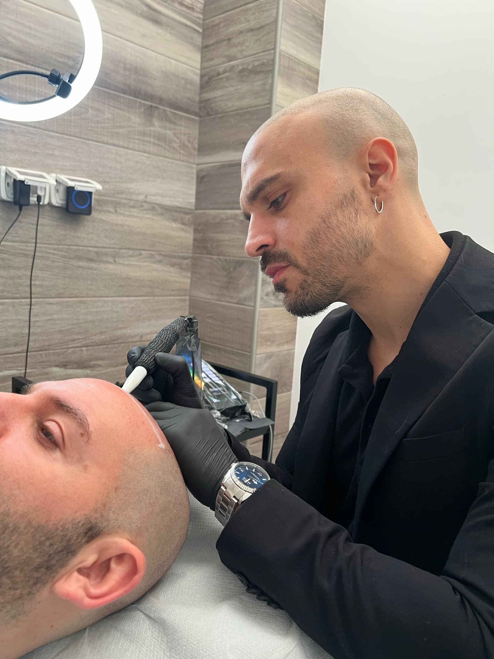 Angelo Mirante durante un trattamento di tricopigmentazione